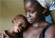 NYT-Kristoff photo-Guinea-Bissau